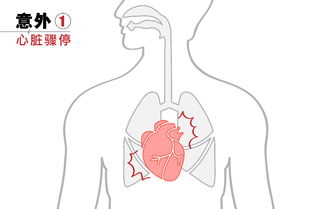 冬季生活急救常识(冬季急救药品)